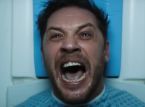 Tom Hardy shares hilarious Venom behind-the-scenes video